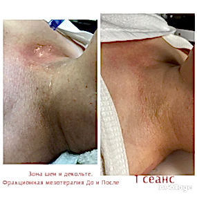 Фото работ: фото