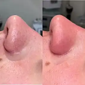 Фото работ: фото