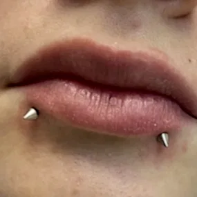 Прокол губ в косметологии мерси Алматы