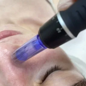 Микронидлинг