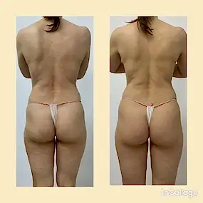 Вибрационный массаж в Алматы Мерси