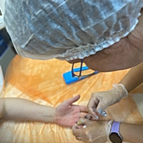 Лечение гипергидороза ладоней Алматы на Дону Мерси Подгальская