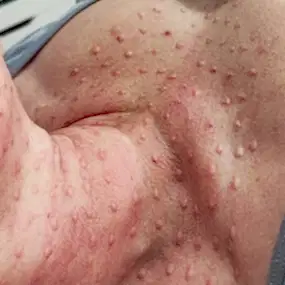 Инъекционная косметология салон Мерси Алматы на Дону Подгалская Ирина