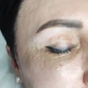 Инъекционная косметология салон Мерси Алматы на Дону Подгалская Ирина