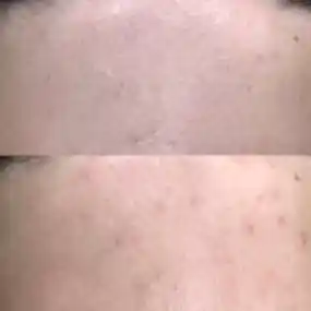 Фото до после: фото