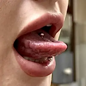 Пирсинг языка в косметологии Мерси Алматы