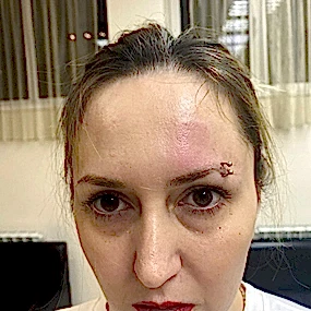 Пирсинг брови